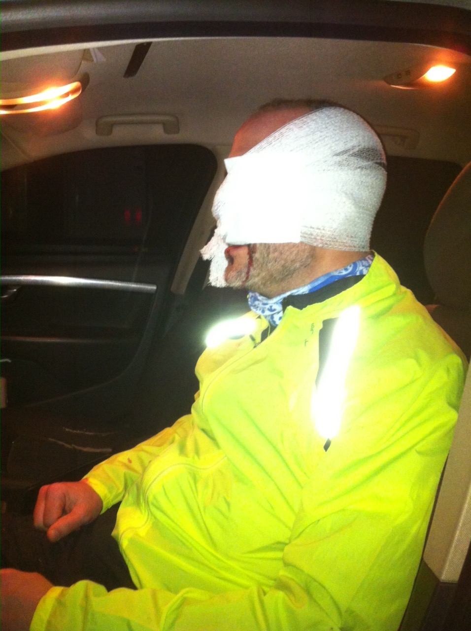 Not a good day to be a cyclist.